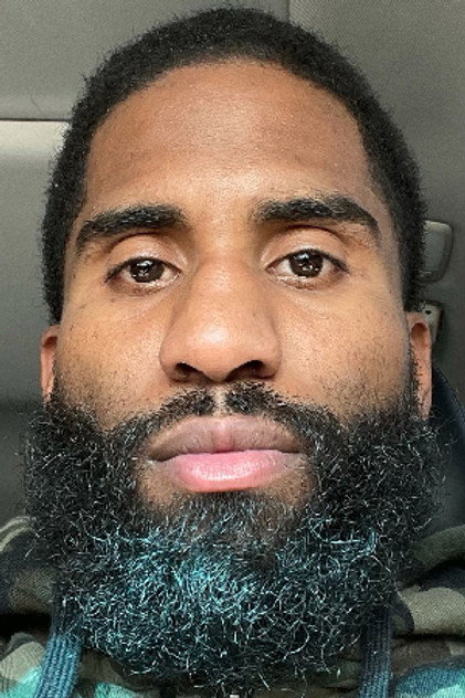 Anthony Young