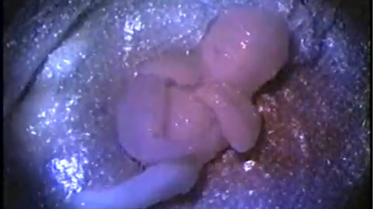 Busted Babies