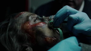 Burned Alive