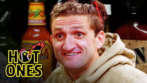 Casey Neistat Melts His Face Off While Eating Spicy Wings